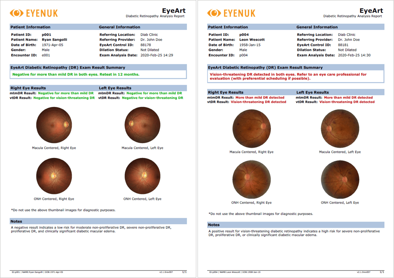 EyeArt-Sample-Report